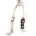 Ironfoot Lower Body.png